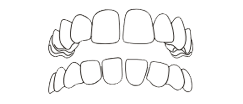 Gap Teeth