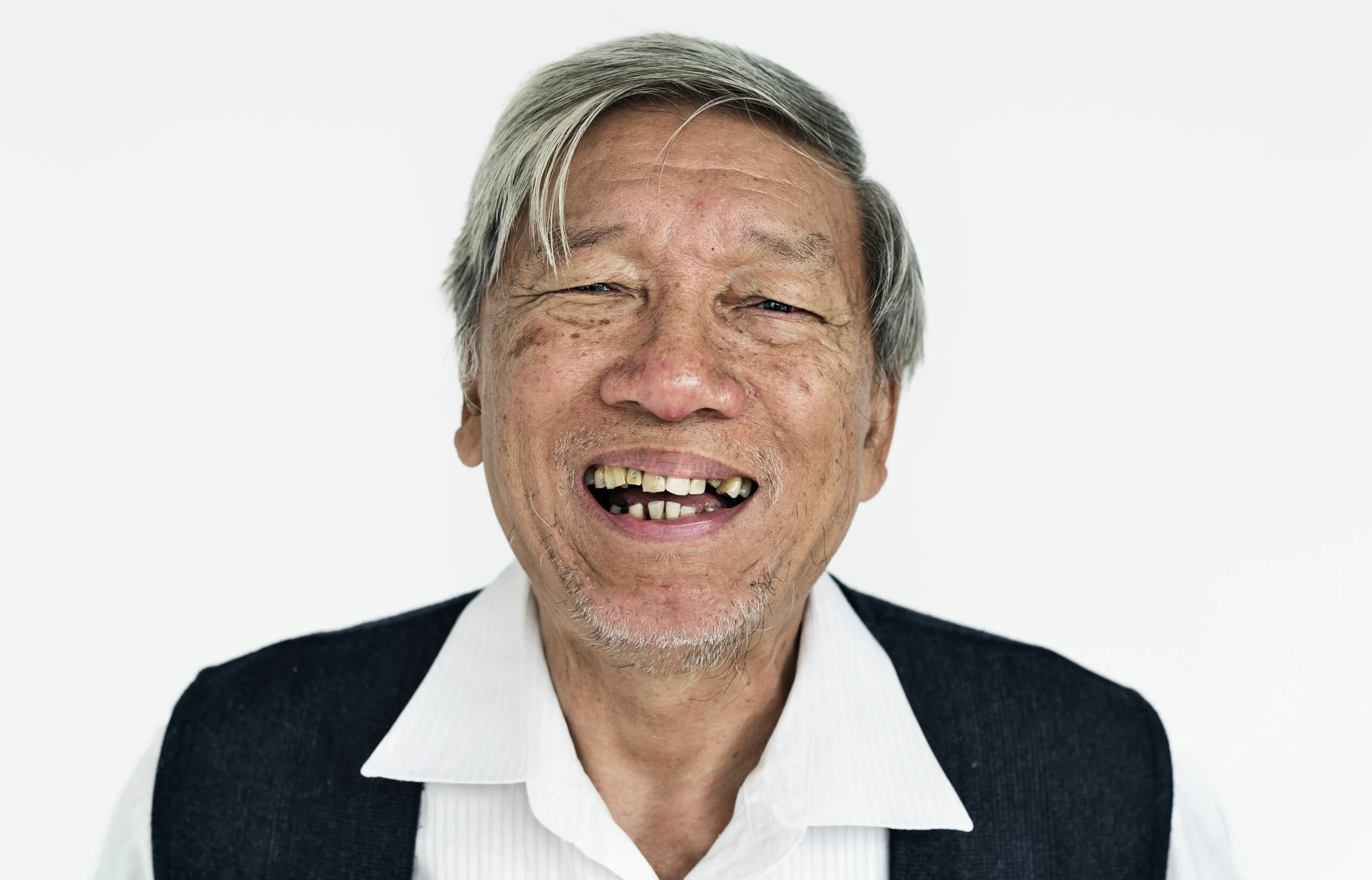 gigi palsu